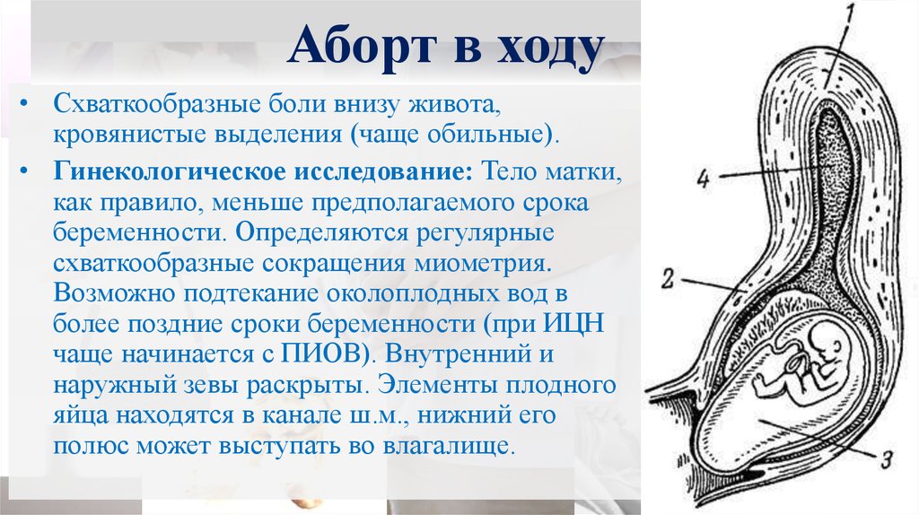 Дипломная работа: Беременность 15 недель угрожающий самопроизвольный выкидыш