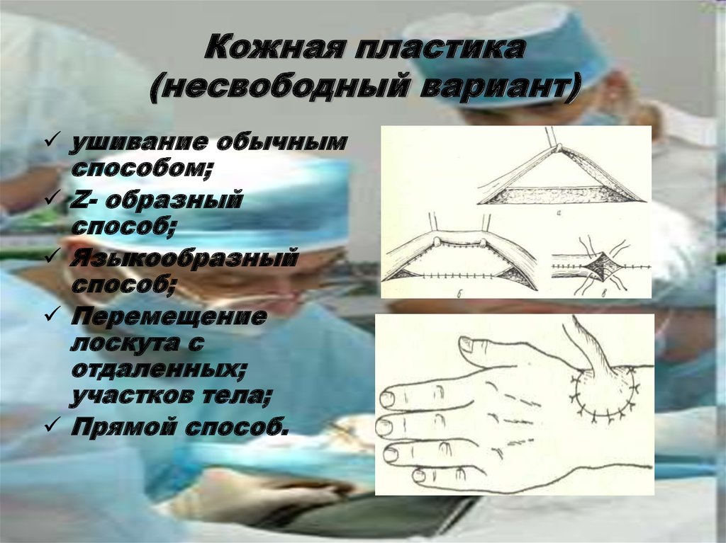 Пластика кожи. Несвободная кожная пластика. Способы свободной кожной пластики. Классификация способов кожной пластики.