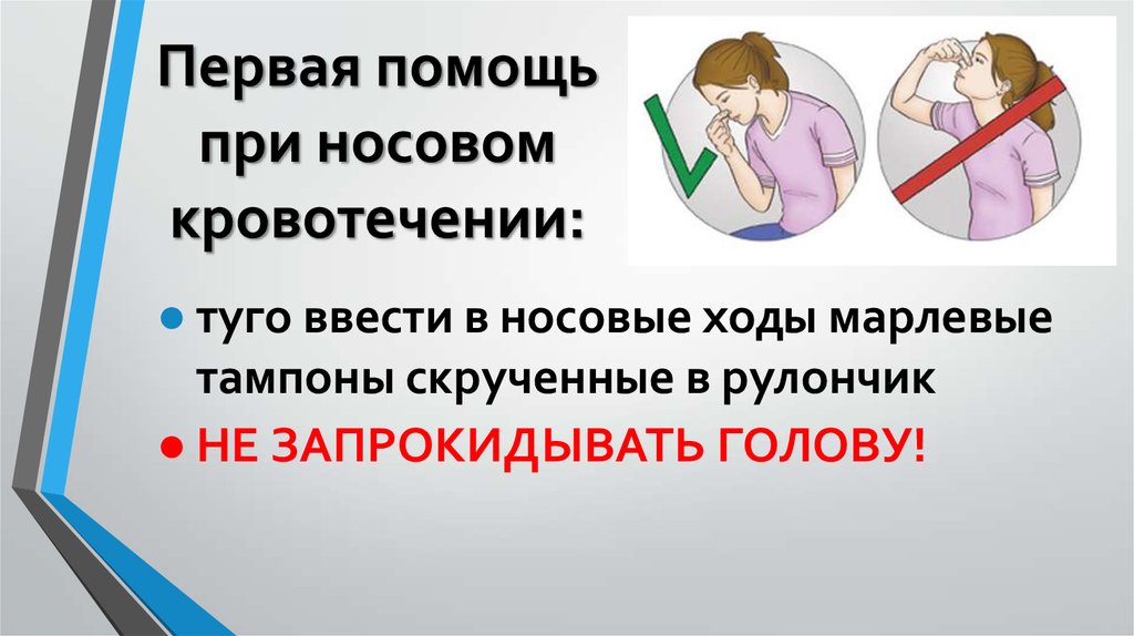 Первая помощь при носовом кровотечении. Оказание первой помощи при носовом кровотечении. Первая помощь при носовом крово. Первач помощь при носовом кровотечение. Первая помощь при ножевом кровотечении.