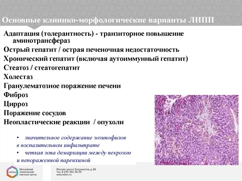 Побочные действия печени. Стеатоз печени гистология. Лекарственные поражения печени клинико-морфологические формы. Морфологический характер поражения печени при гепатитах:. Острая печеночная недостаточность гистология.