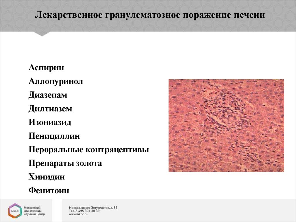 Токсическое поражение печени мкб 10