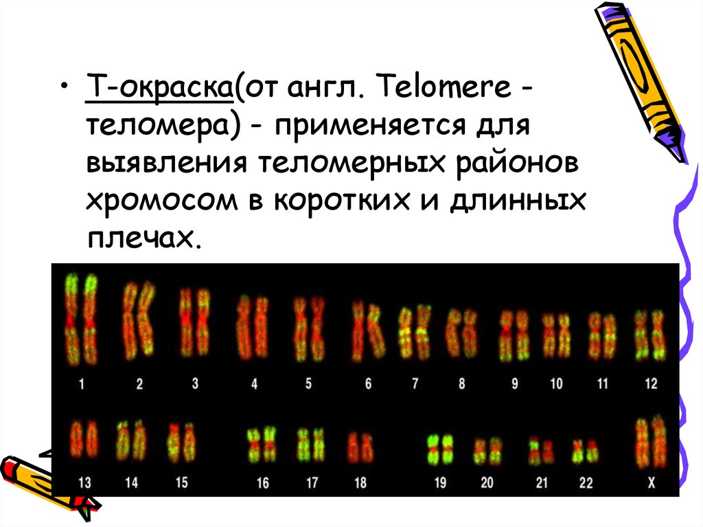 Изменение окраски хромосом. Цитогенетические методы дифференциальное окрашивание хромосом. T окраска хромосом. Цитогенетический метод окрашивание хромосом. Методы дифференциальной окраски хромосом.
