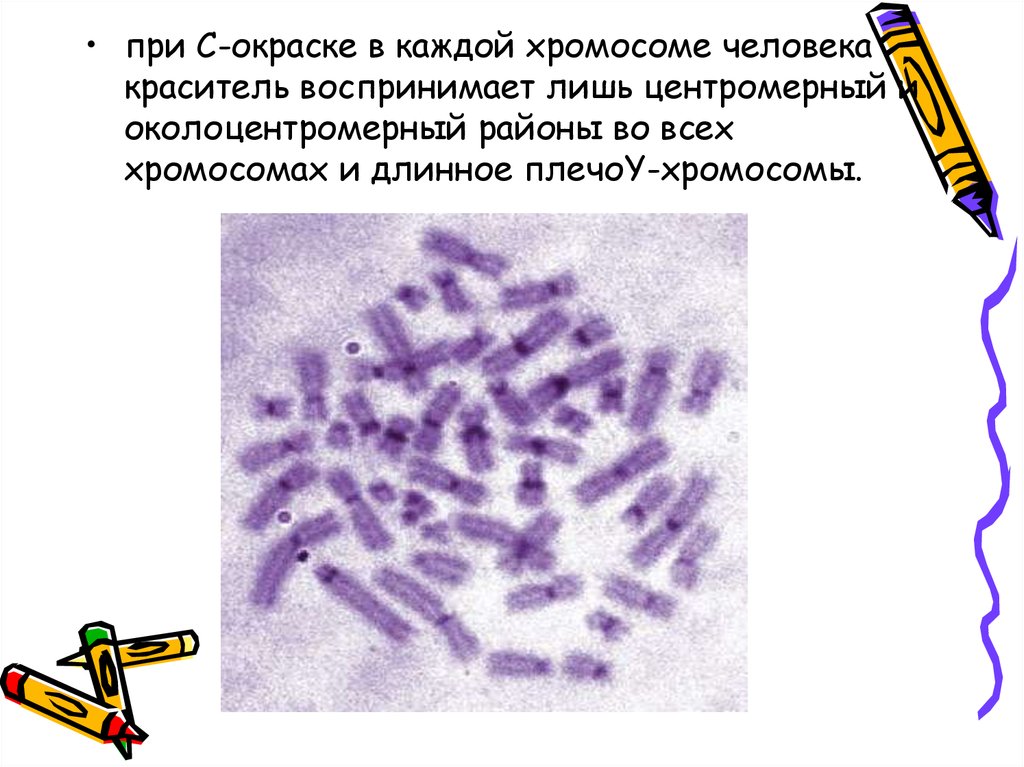 Изменение окраски хромосом. Метод дифференциальной окраски хромосом. Окрашивание хромосом.