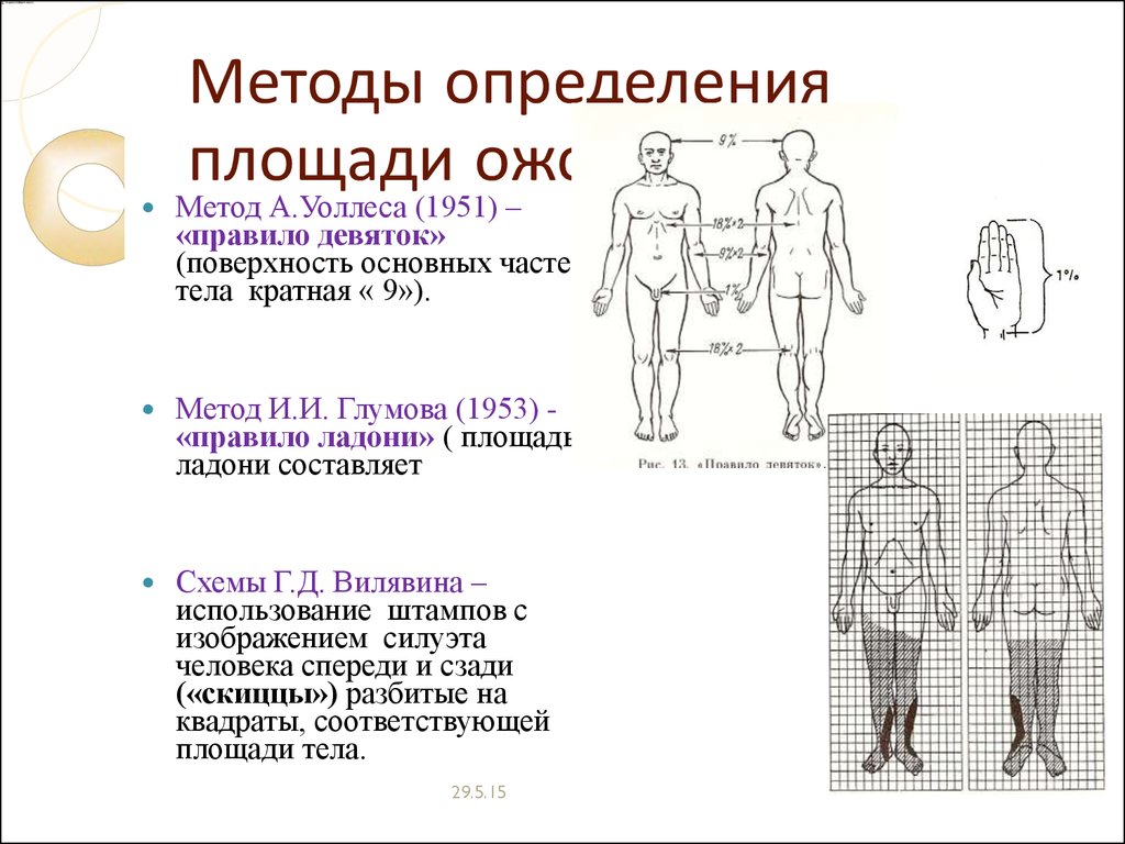 Методы определения человека. Схема Вилявина для определения площади ожога. Метод Вилявина ожоги. Метод определения площади ожогов. Методы оценки площади ожога.