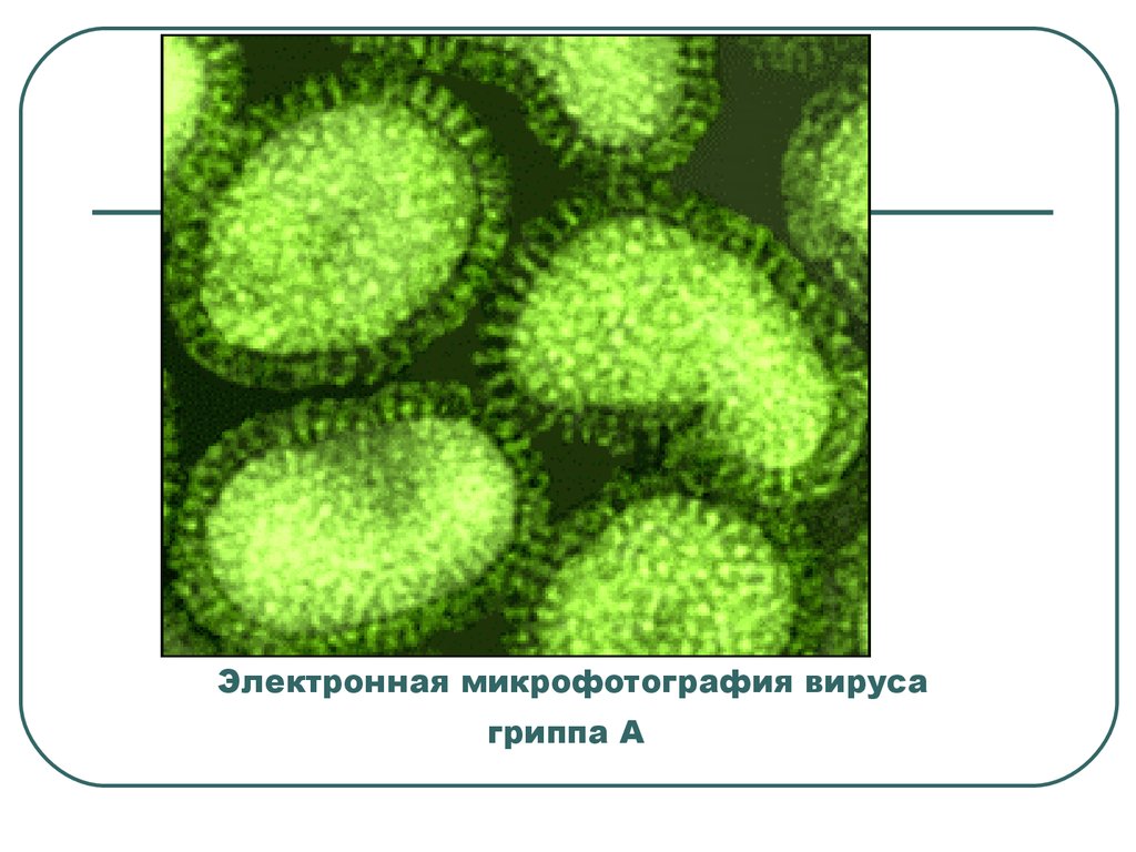 Вирус гриппа группа. Вирус парагриппа микрофотография. Электронная микрофотография вируса гриппа а. Типы вирусов. Возбудитель гриппа.
