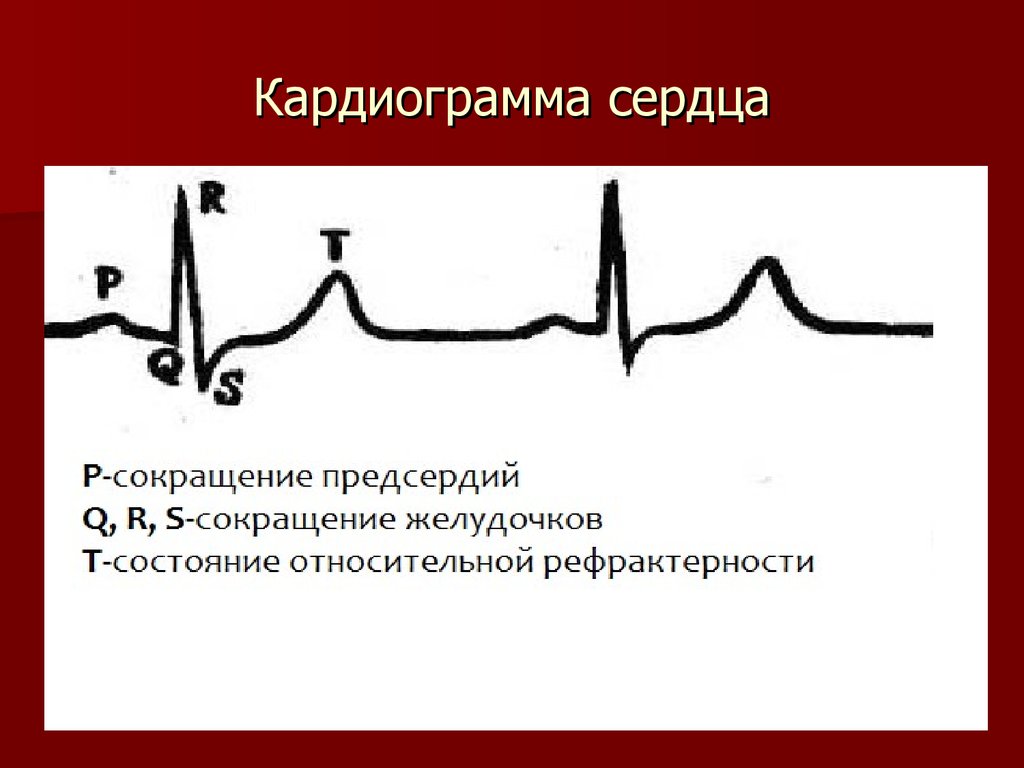 Экг что это такое. ЭКГ сердца. Кардиограмма сердца. Кардиограмма сердца здорового человека. Правильная кардиограмма.