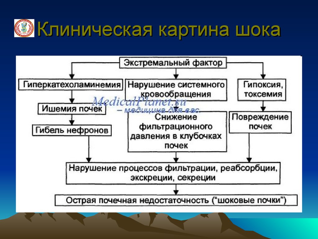 Ожоговый шок патогенез схема