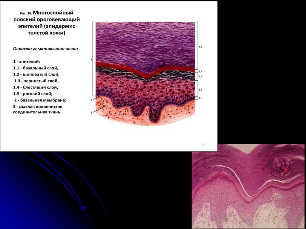 Многослойный ороговевающий эпителий. Препарат: плоский ороговевающий эпителий (эпидермис кожи).. Многослойный плоский ороговевающий эпителий толстой кожи. Многослойный плоский ороговевающий эпителий эпидермиса кожи. Многослойный плоский ороговевающий эпителий эпидермис кожи пальца.