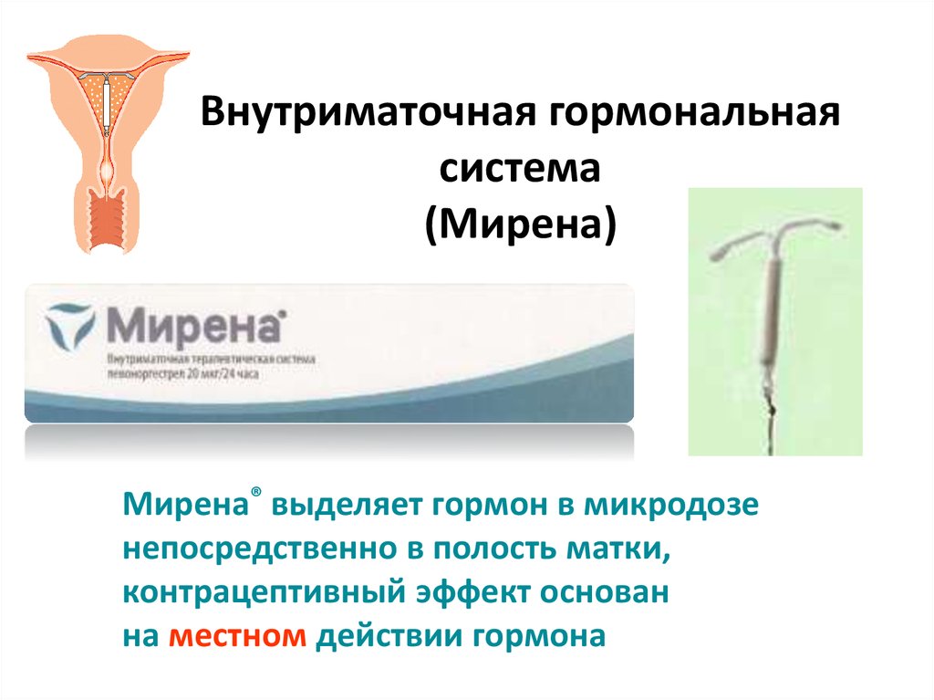 Жизнь после установки спирали. Спираль Мирена внутриматочная. Внутриматочная гормональная спираль Мирена. Внутриматочная спираль Mirena. Гормоносодержащие спирали Мирена.