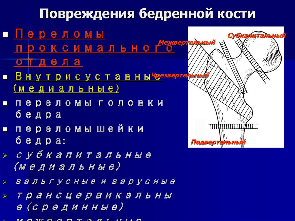 Повреждение бедренной кости. Ранение бедренной кости. Статистика перелома бедренной кости. Рентгенодиагностика травматических повреждений костей и суставов.