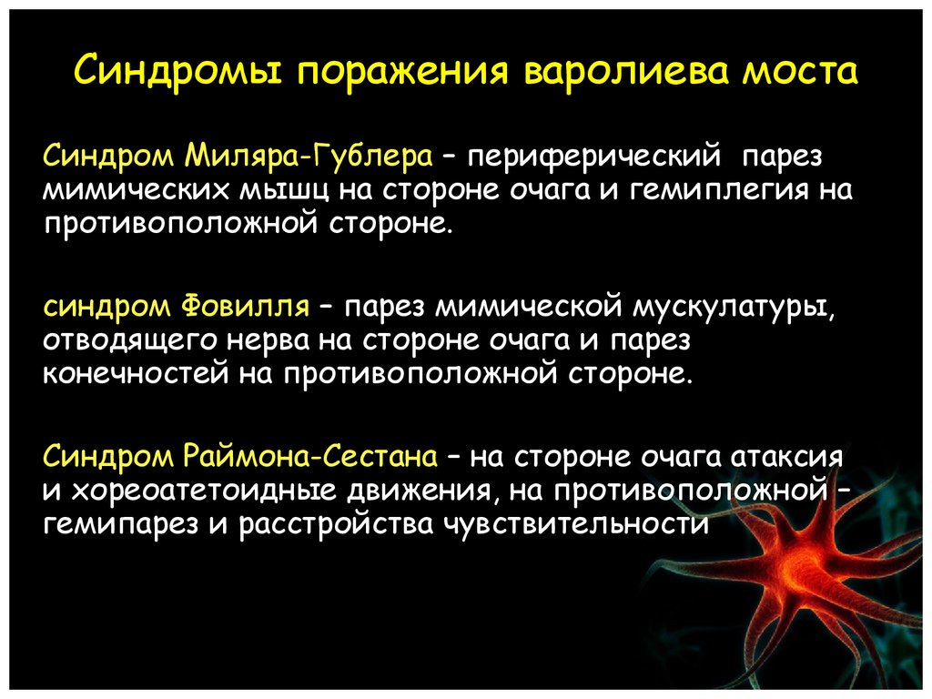 Синдром фовилля. Симптомы поражения моста. Синдромы поражения моста. Синдромы поражения варолиева моста. Поражения варолив моста.