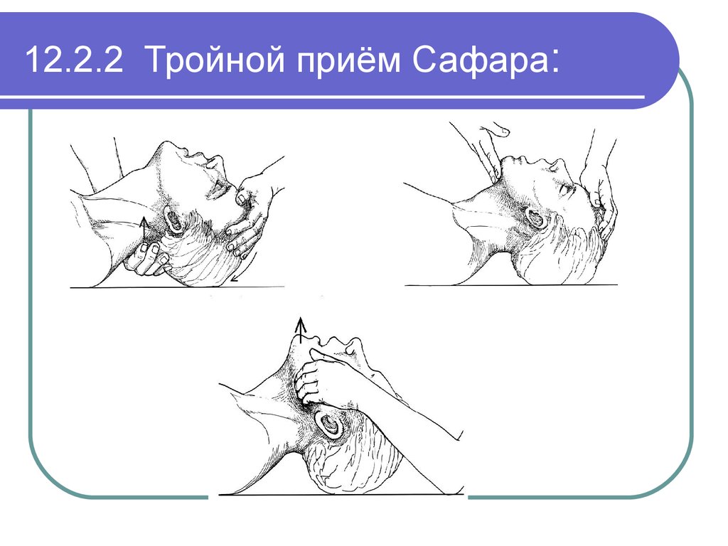 Тройной прием сафара картинки