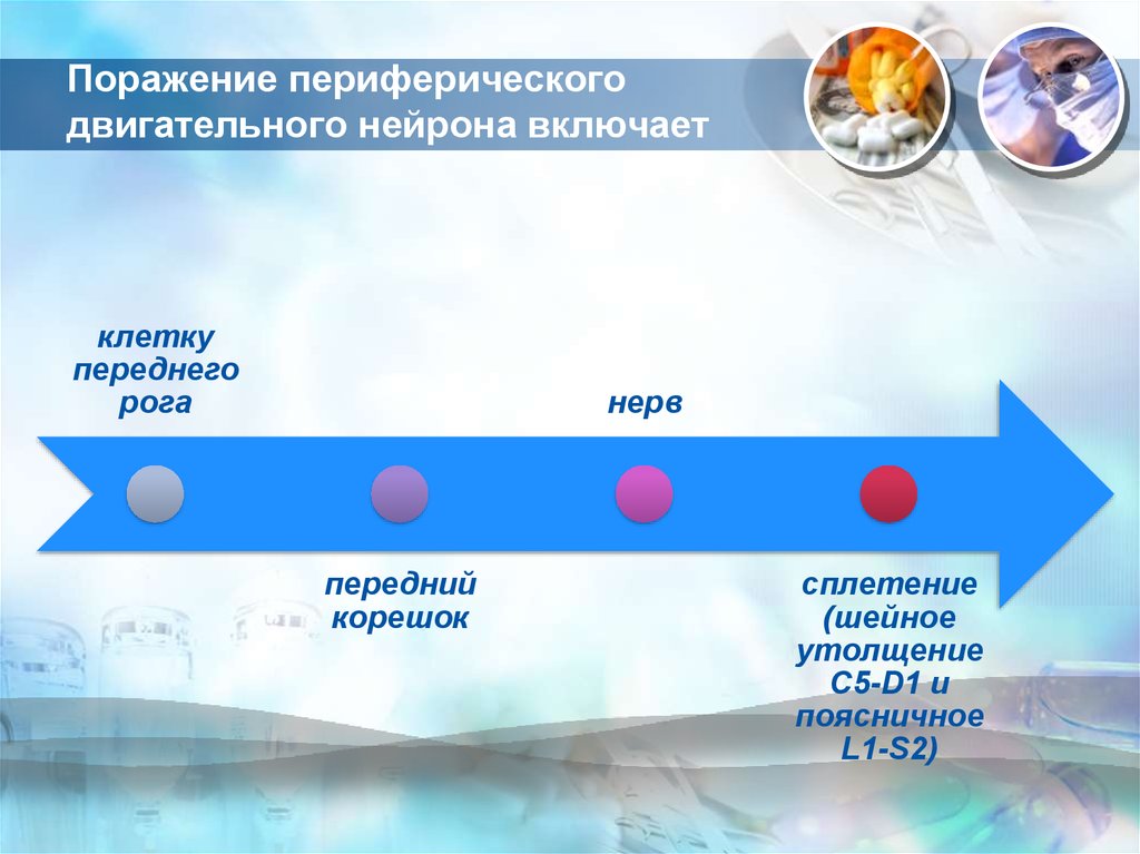 Поражения центрального двигательного нейрона