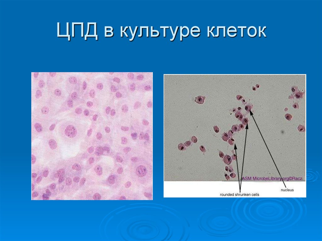 Цпд это микробиология