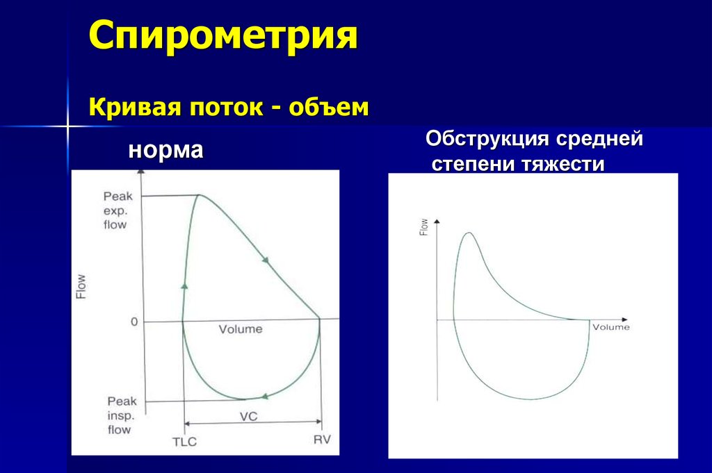 Кривая объема