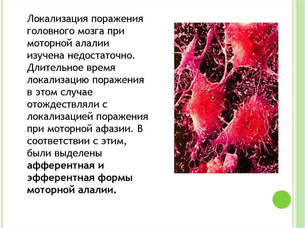 Локализация поражения. Моторная алалия локализация поражения. Сенсорная алалия локализация поражения. Поражение головного мозга при моторной алалии. Локализация поражений мозга.