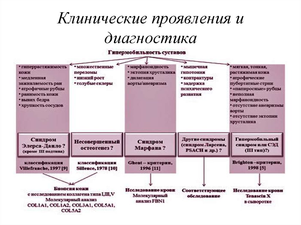 Дисплазия тканей. Синдром системной дисплазии соединительной ткани. Диагностика синдрома дисплазии соединительной ткани. Дисплазия соединительной ткани дифференциальная диагностика. Дисплазия соединительной ткани дифференциальный диагноз.