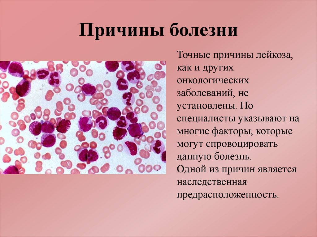 Злокачественный лейкоз