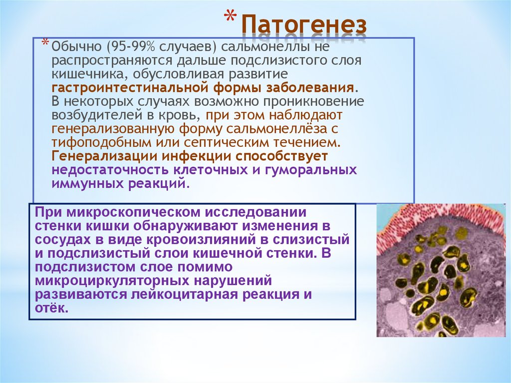 Сальмонеллез кишечника
