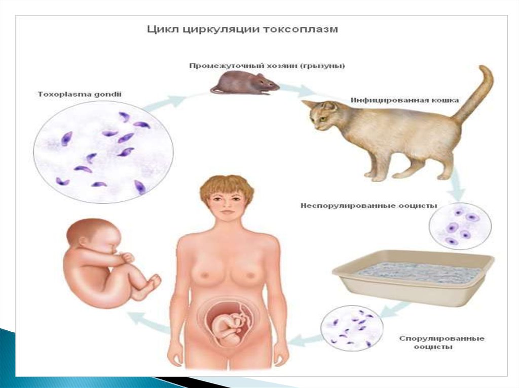 Токсоплазмоз у новорожденных презентация