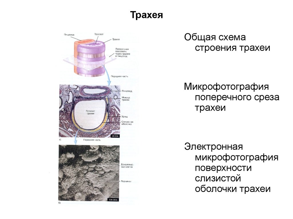 Поперечный срез трахеи. Трахея электронная микрофотография. Срез трахеи.