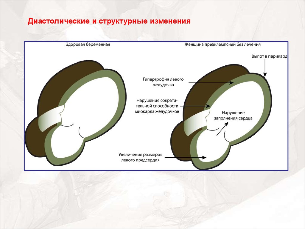 Структурные изменения