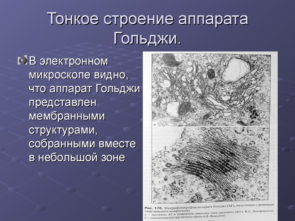 Строение аппарата. Аппарат Гольджи микроскоп. Аппарат Гольджи в электронном микроскопе. Тонкое строение аппарата Гольджи. Комплекс Гольджи световой микроскоп.