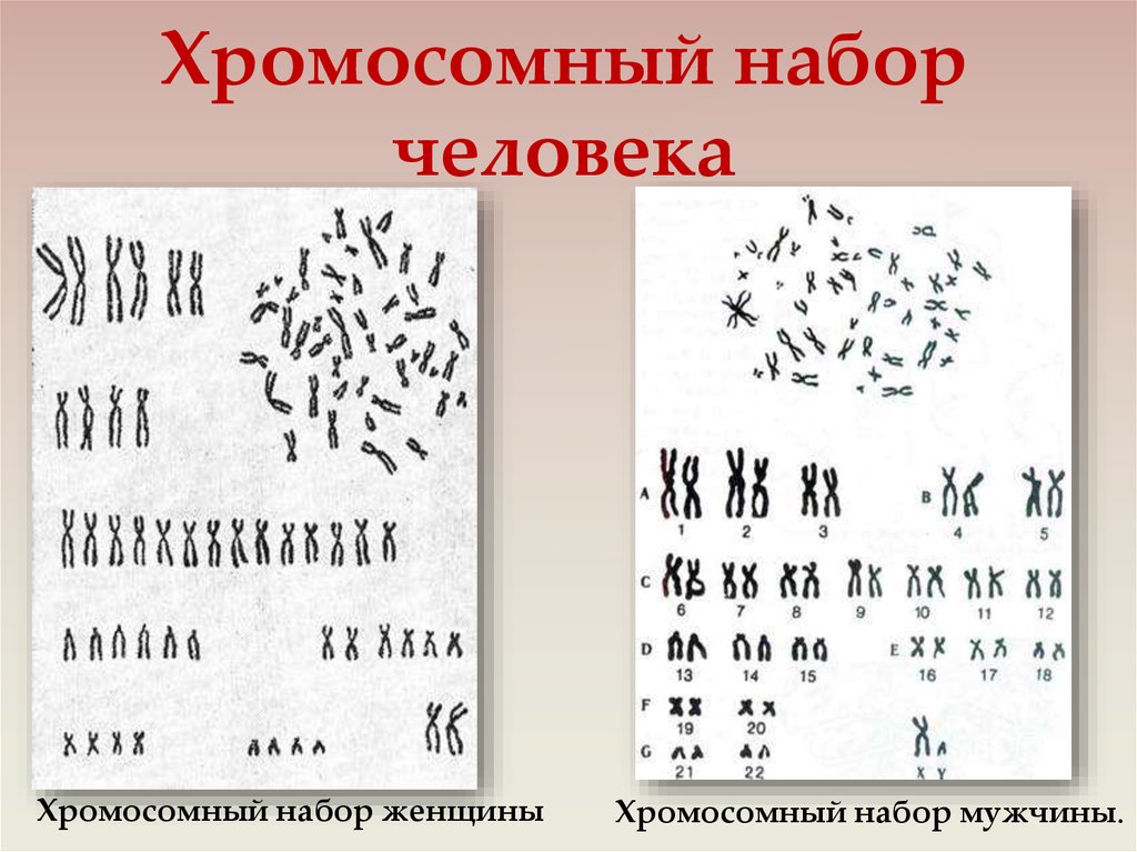 Хромосомы женщины и мужчины. Хромосомный набор человека. Набор хромосом у человека. Хромомосмоный набор человека. Хромосомный набор женщины.