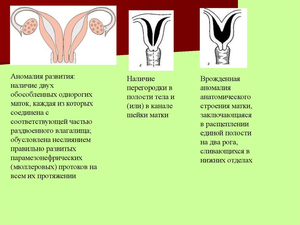 Аномалии развития матки. Пороки женской половой системы. Аномалии развития женских органов. Врожденные аномалии развития половых органов.