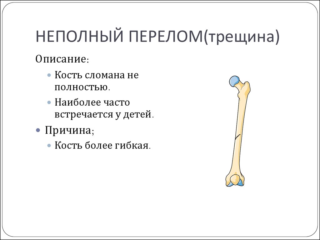 Симптомы перелома или трещины. Полный и не полный передом. Неполные переломы костей. Неполный перелом кости.