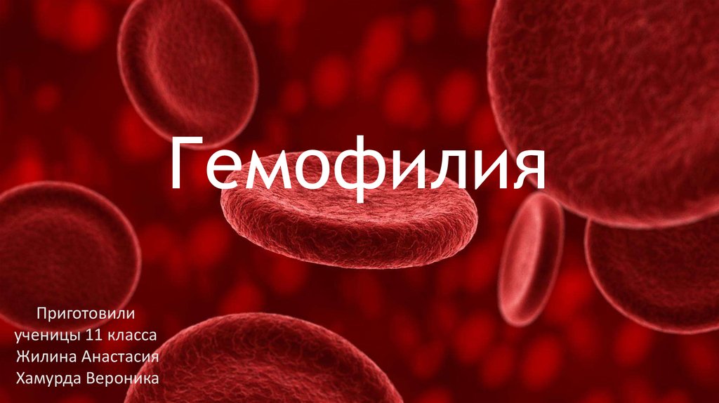 Презентация на тему гемофилия