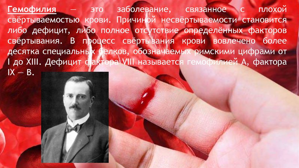 Гемофилия. Симптомы - презентация онлайн