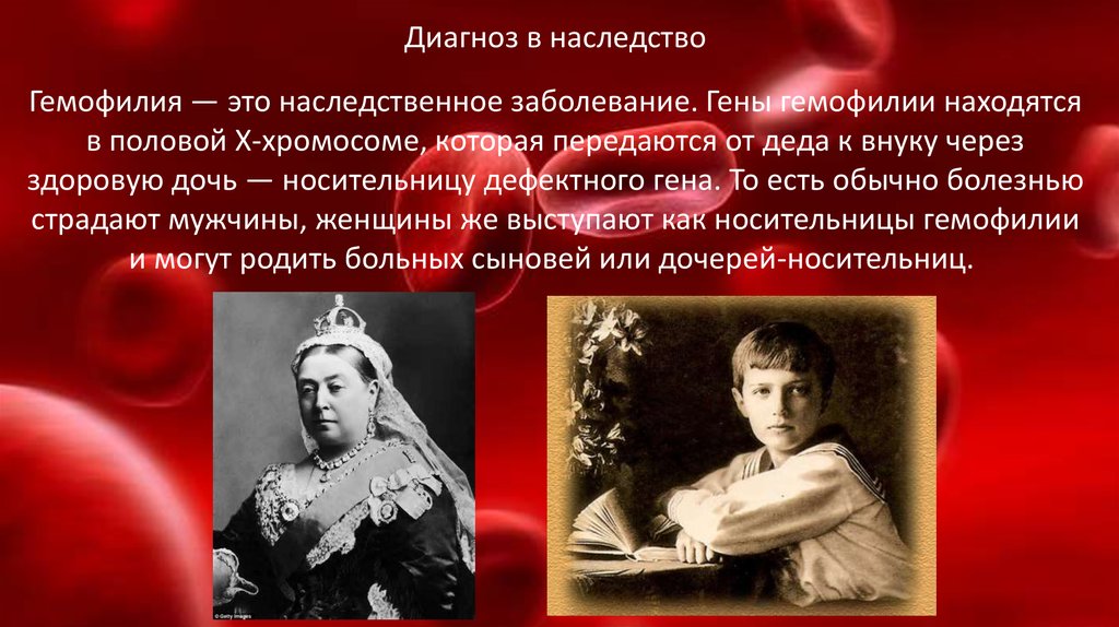 Гемофилия. Симптомы - презентация онлайн