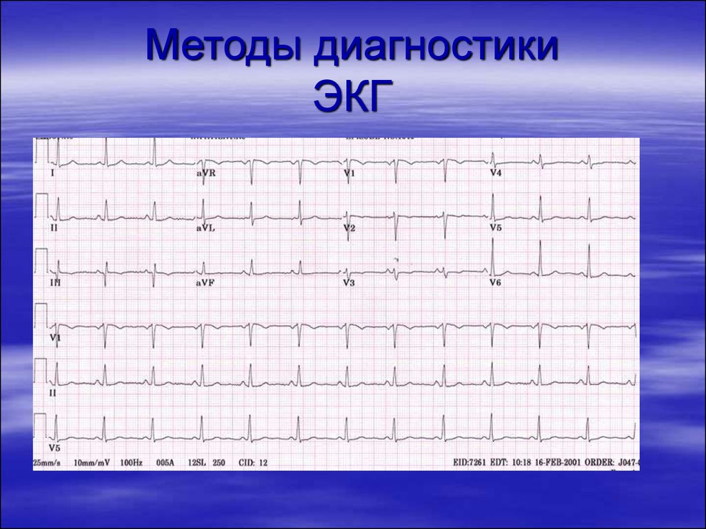 Экг диагностика. Методы диагностики ЭКГ. ЭКГ метод диагностики. ЭКГ диагнозы.