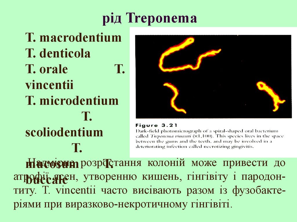 Treponema pallidum отрицательный. Treponema denticola микробиология. Ферменты агрессии трепонема паллидум.