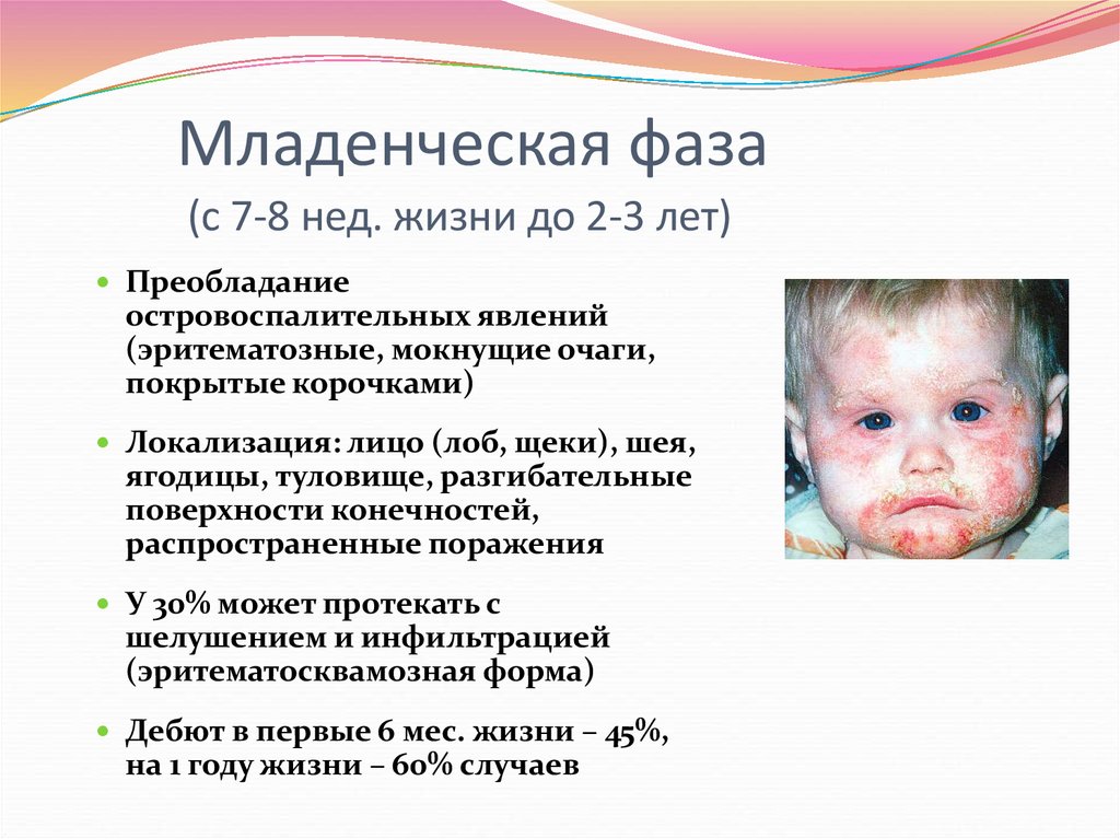 Младенческая фаза (с 7-8 нед. жизни до 2-3 лет)