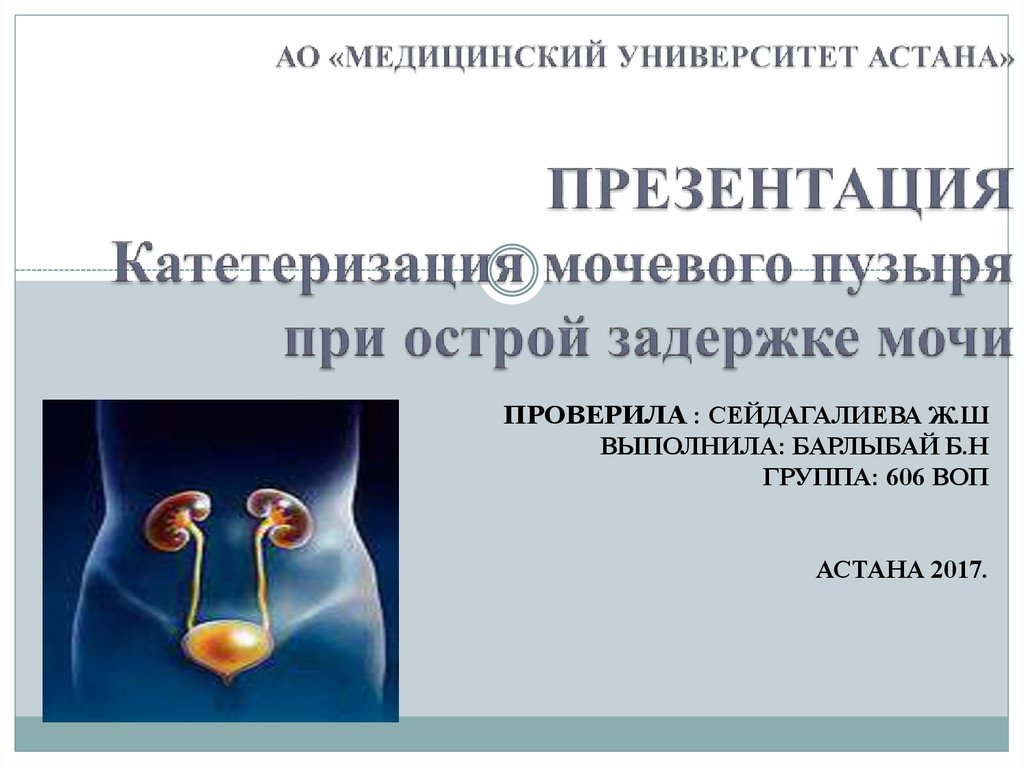 Лечение задержки мочи у женщин. Острая задержка мочи презентация. Острая задержка мочи клиника. Катетеризация мочевого пузыря при острой задержке мочи. Симптомы при острой задержке мочи.