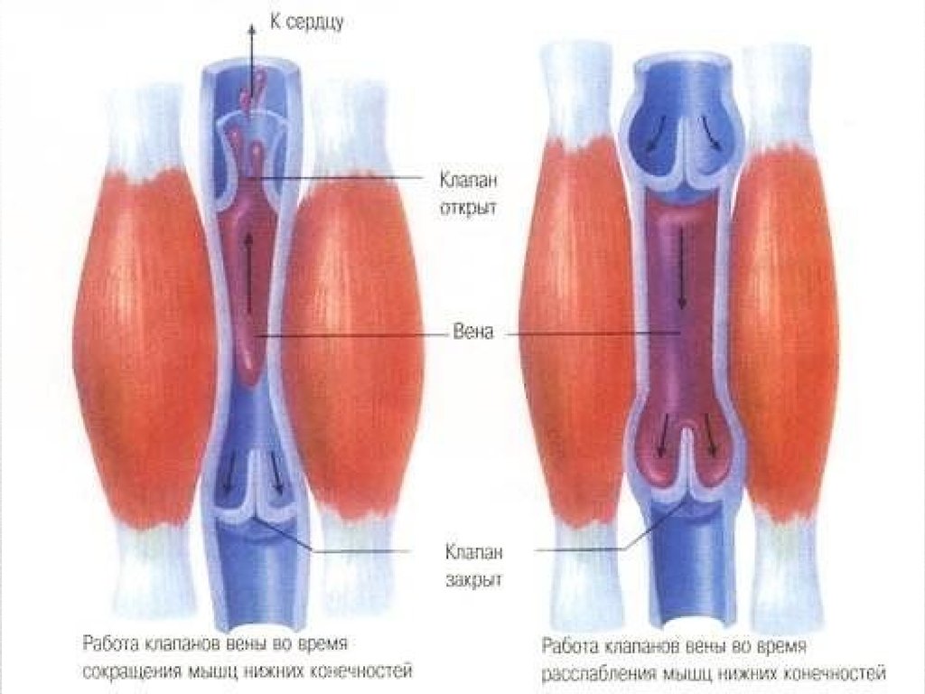 varicoza malco