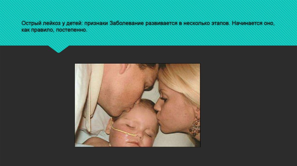 Острый лейкоз у детей: признаки Заболевание развивается в несколько этапов. Начинается оно, как правило, постепенно.