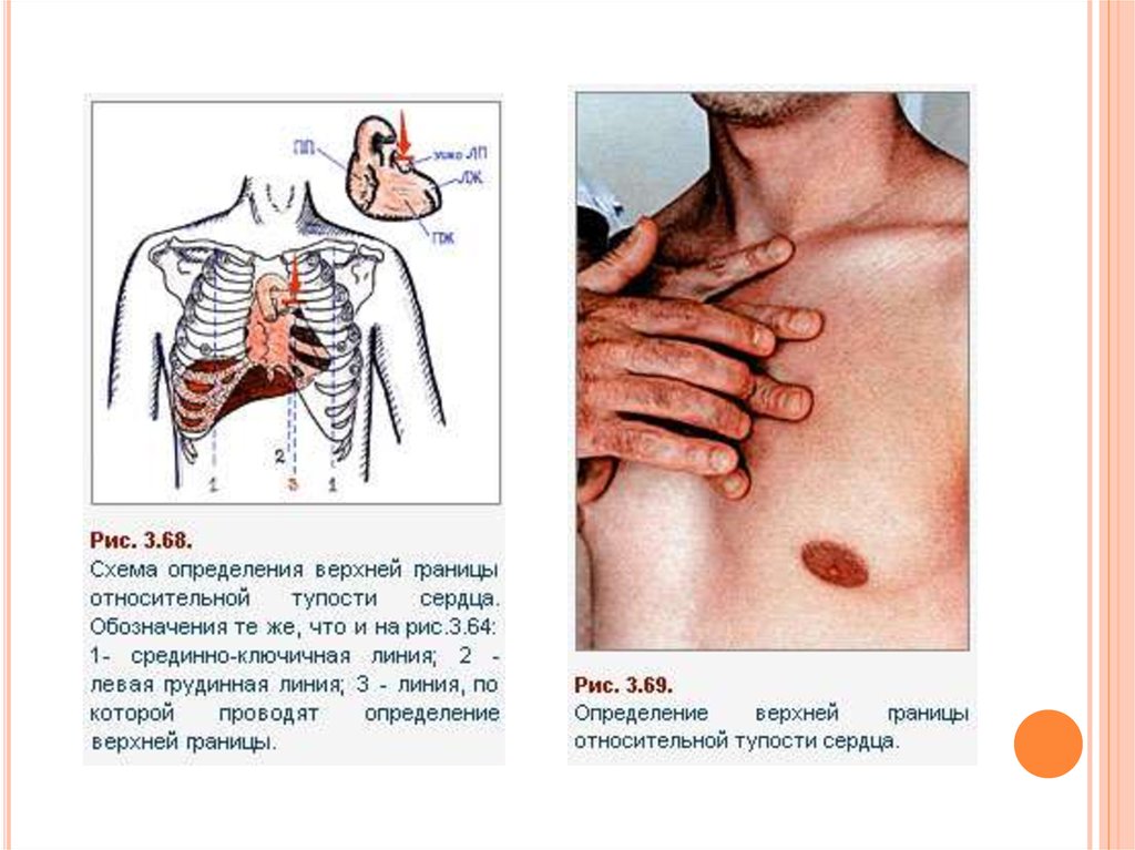 Пальпация сердца презентация