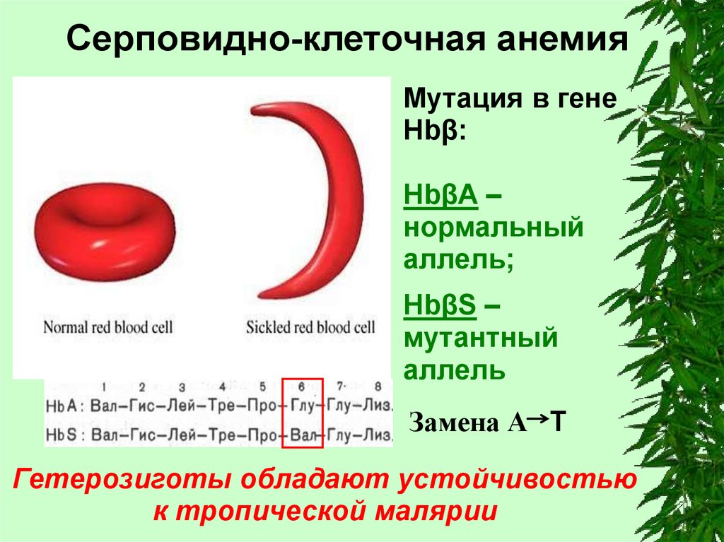 Серповидноклеточная анемия какая. Серповидноклеточная анемия вид мутации. Серповидная анемия генное заболевание. Серповидно клеточная анемияъ. Сероповидно клеточная анемия.