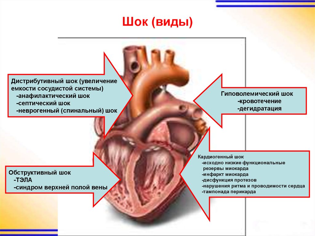 Шок презентация патология