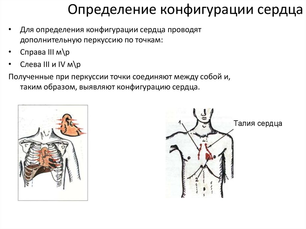 Определение абсолютной тупости сердца