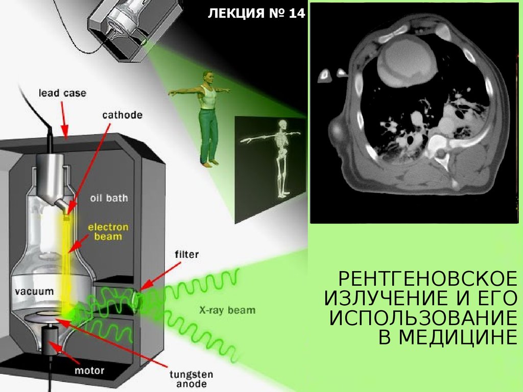 Излучение реликтового фона