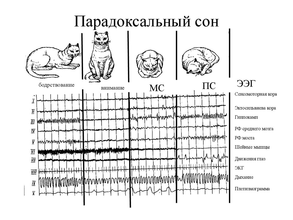 Рассмотрите рисунки изображающие электроэнцефалограммы спящего человека 206