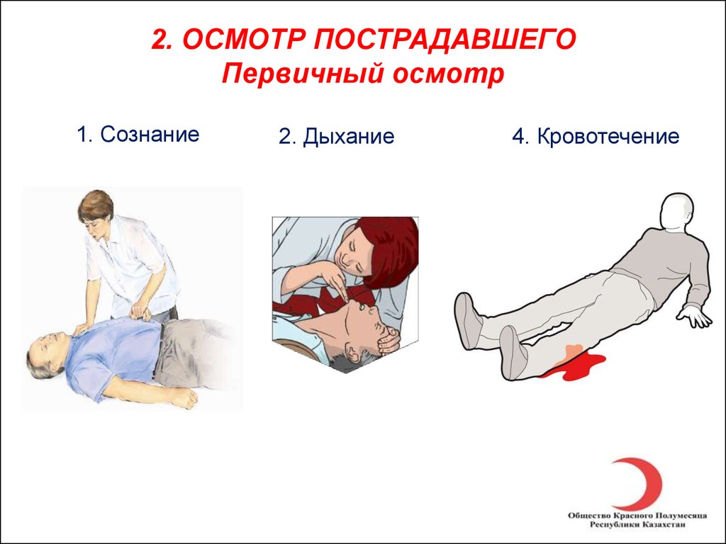 У пострадавших в дтп находящихся без сознания пульс определяют