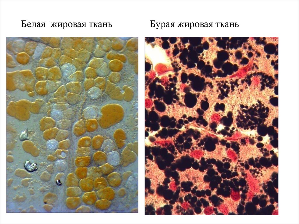 Жировая ткань. Бурая жировая ткань. Белая и бурая жировая ткань. Строение бурой жировой ткани. Бурый жир гистология.