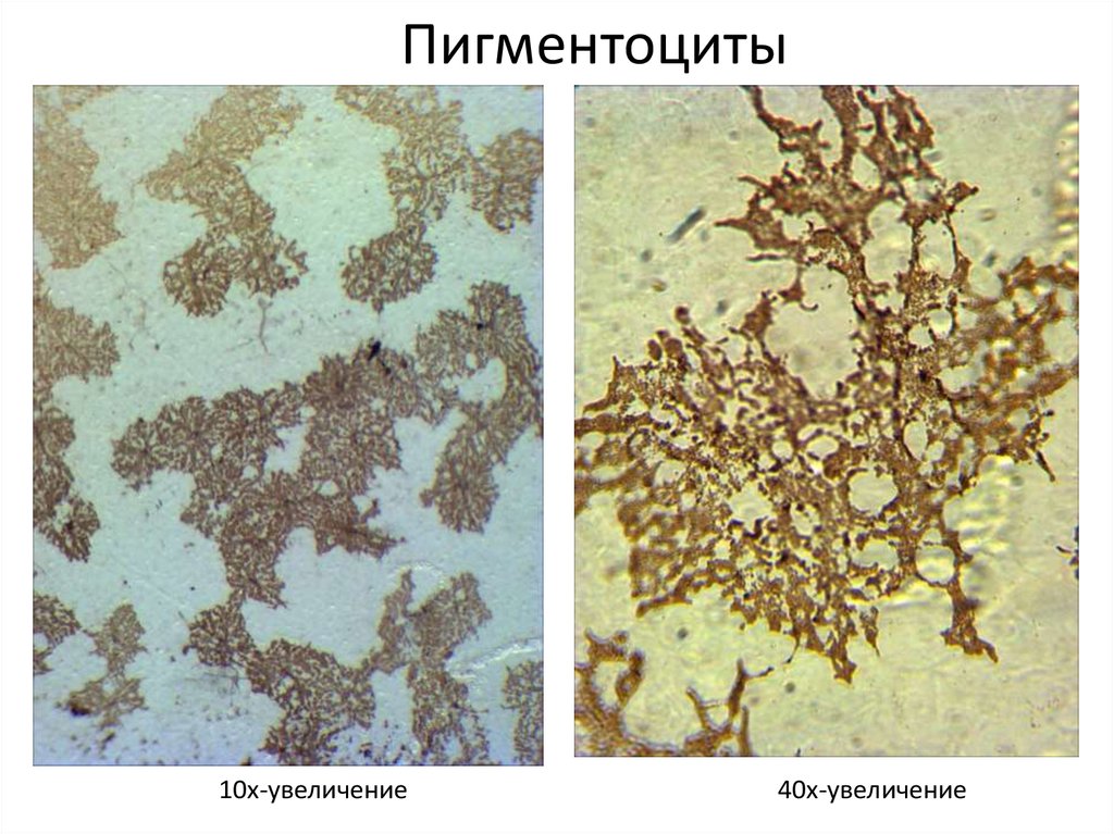 Увеличение х. Пигментные клетки гистология. Пигментоциты гистология. Пигментоцит функции гистология. Пигментоциты это пигментные клетки.