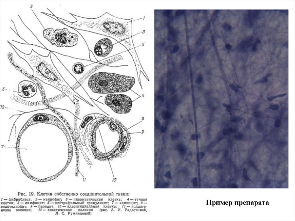 Собственные клетки. Клетки собственно соединительной ткани. Собственные клетки соединительной ткани. Собственная соединительная ткань. Соединительная ткань собственно соединительная.