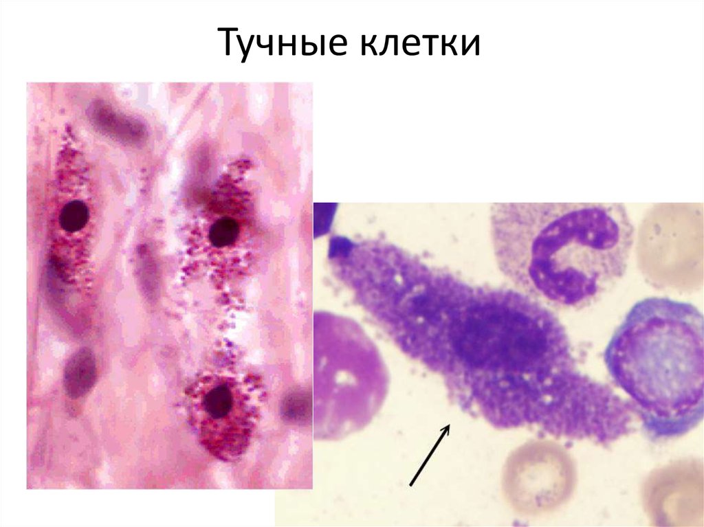 Тучные клетки фото под микроскопом